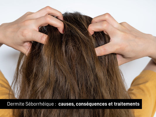 dermite séborrhéique : causes, conséquences et traitements article